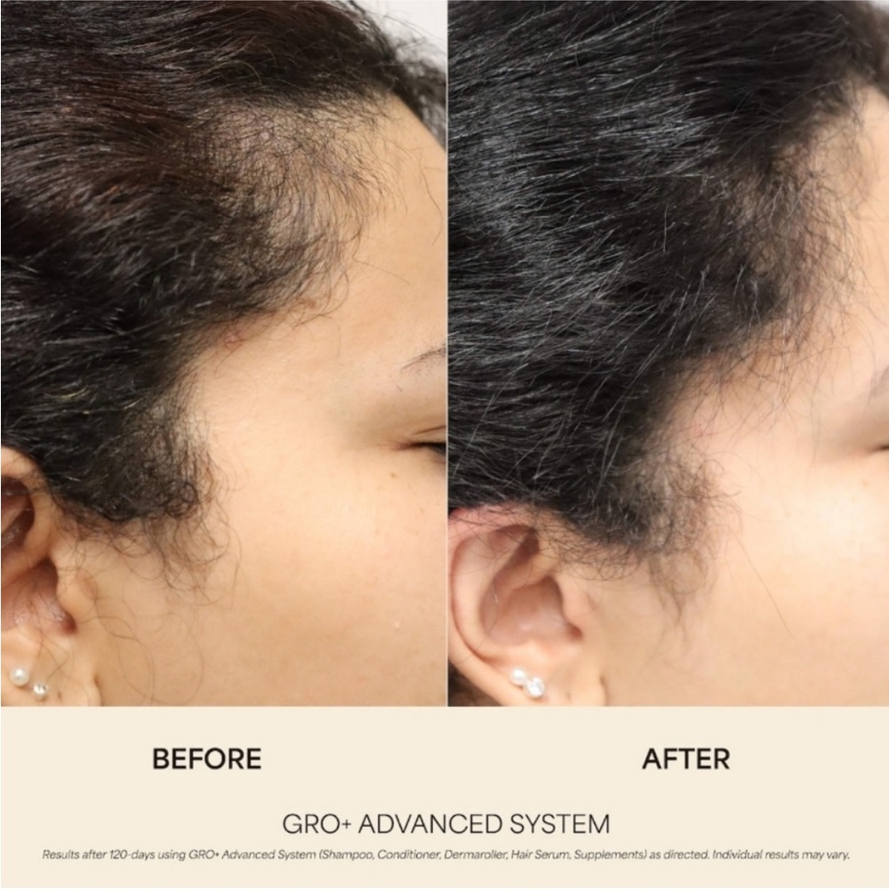 NIB VEGAMOUR GRO ADVANCED HAIR GROWTH SYSTEM - Picture 4 of 10
